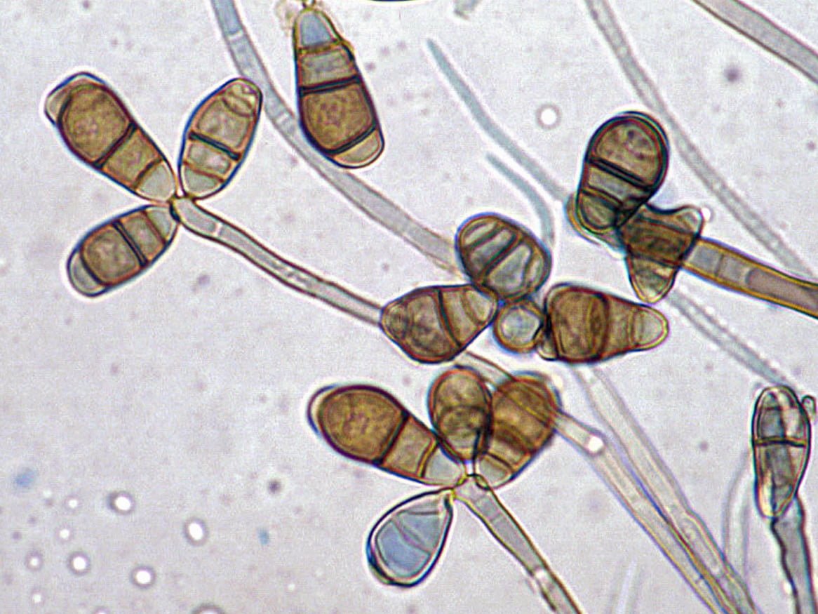 Hình ảnh hiển vi của nấm Curvularia sp - Lưới Trung Lương Hình ảnh hiển vi của nấm Curvularia sp